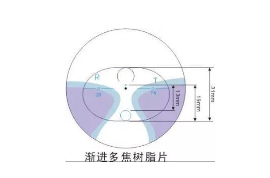 美麗島漸進(jìn)多焦鏡適合的人群，需要注意的事項